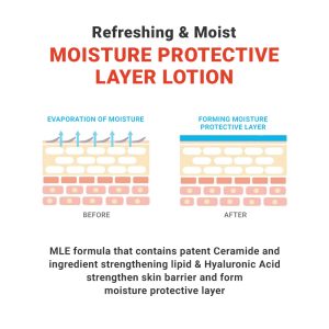 ATOPALM MLE Lotion 300ml, Langanhaltende Gesicht bis Körper Feuchtigkeitscreme, Anti-Juckreiz Baby Kinder Erwachsene Hypoallergen Gesichtscreme Körperlotion, Tagescreme Gesichtspflege, Koreanische 15