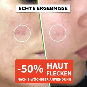 60ml Bio Hyaluron Serum mit Vitamin C, E. Hochkonzentriert Anti-Falten, Anti-Aging und Dunkle-Flecken. Hyaluronsäure-Gesichtsserum, ideal als Augenkonturcreme und für Dermaroller. Vegane Naturkosmetik 11