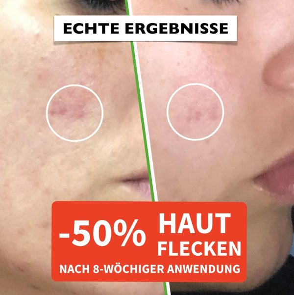 60ml Bio Hyaluron Serum mit Vitamin C, E. Hochkonzentriert Anti-Falten, Anti-Aging und Dunkle-Flecken. Hyaluronsäure-Gesichtsserum, ideal als Augenkonturcreme und für Dermaroller. Vegane Naturkosmetik 4