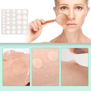 Pimple Patches Hydrokolloid Unsichtbare Pickel Patch mit Teebaumöl Tag und Nacht Verwenden Pimple Patch Akne Patches Wasserdichte Atmungsaktive Acne Patch Pflaster Anti (264 Stück) 12