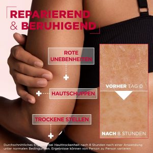 Mixa Hochkonzentrierte Feuchtigkeitspflege für Gesicht, Körper und Hände, Bei trockener und rissiger Haut, Mit Urea und Niacinamiden, Urea Cica Repair+, 150 ml 11