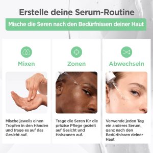 Mixa Anti-Unreinheiten Serum, Für zu Akne neigende und sensible Haut, Mit Salicylsäure, Squalan und Niacinamid, Geeignet für Gesicht & Hals, Hypoallergen, 30 ml 25